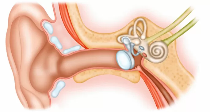 Doç.Dr.Asuman Sevin Kulak Estetiği ve Kepçe Kulak Tedavisini Anlatıyor