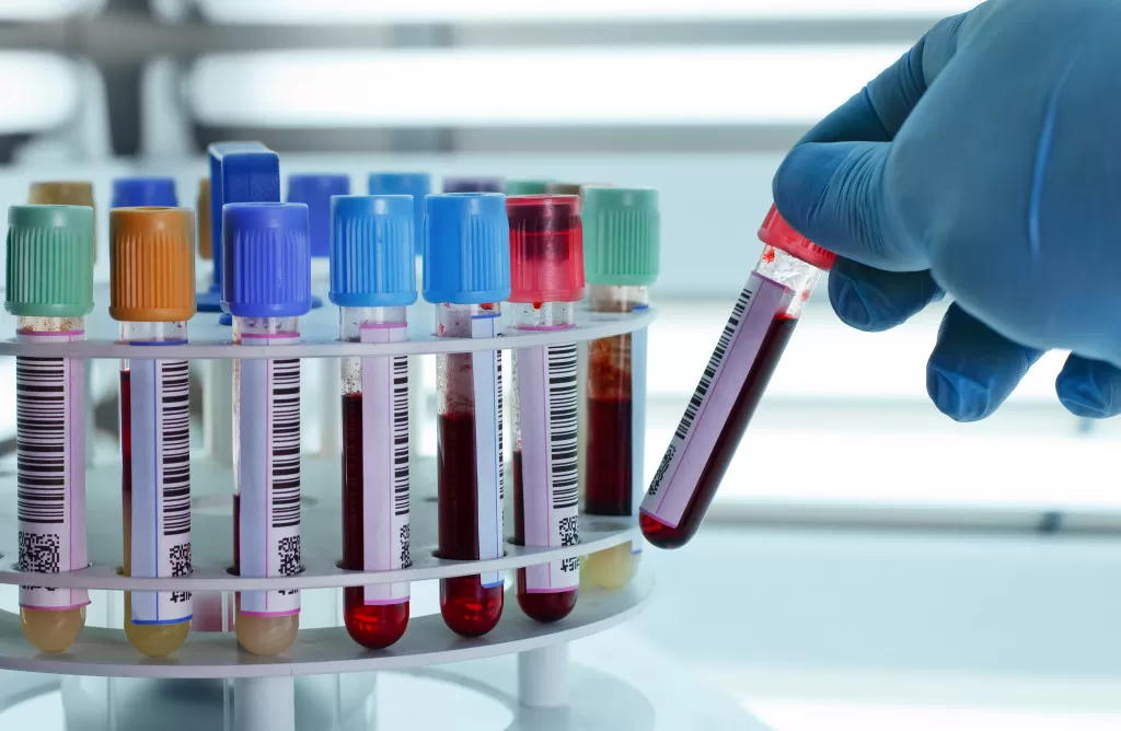 Kan Testi Nedir? Kan Testi Çeşitleri Nelerdir?