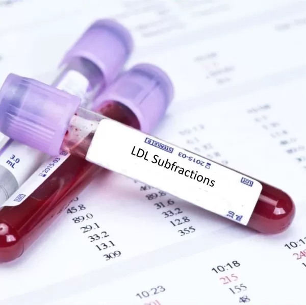 LDL Kolesterol Nedir LDL Testi Nasıl Yapılır?