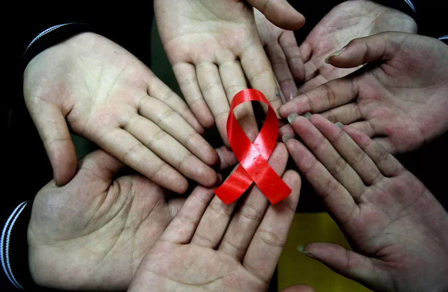 HIV + Kişilerde Görülen Belirtiler Nelerdir?