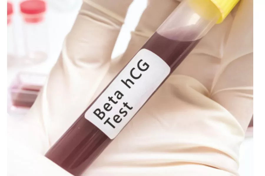 Beta HCG Testi Değerlerinde Gri Zon Nedir? Beta HCG Değerleri ve Gebelik Haftası