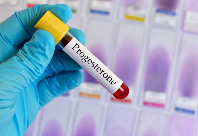 Progesteron Testi Nedir ve Ne Zaman Yapılır? Progesteron Yüksekliği ve Düşüklüğü
