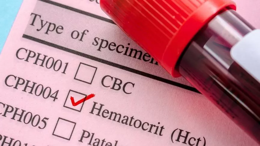 Hematokrit Testi: Hematokrit Yüksekliği ve Düşüklüğü ile Belirtileri Nedir?