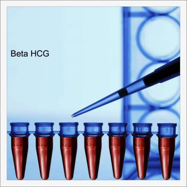 Beta HCG Testi: Beta HCG Değerleri Yorumlanması ve Hesaplanması