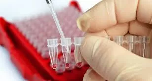 Kanser Kan Testleri: Kanser Teşhisinde Kullanılan Laboratuvar Testleri