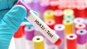 HbA1c Testi Nedir? HbA1c Normal Değerleri ve Yorumlanması