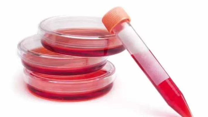 Kan Testi: İmmünoglobulin E (IgE)
