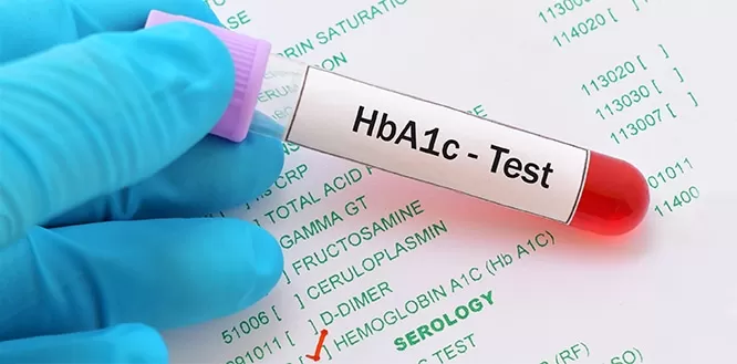 Hemoglobin A1c Testi Nedir? Normal Değerleri Nelerdir?